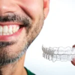 Hva kan du forvente nar du tar tannregulering