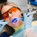 Tannbleking hjemme vs. Hos Tannlege