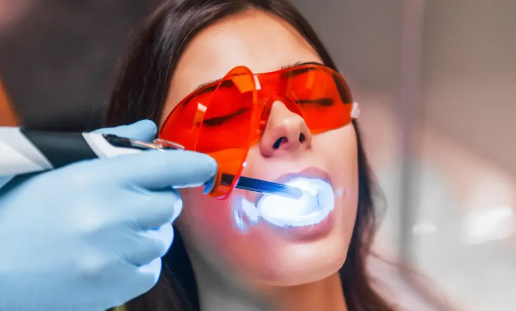 Tips etter fylling av en tann